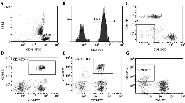 Analysis of T-lymphocyte subsets and NK cell activity in peripheral blood of group OSAHS (children with OSAHS). A: CD45-FITC, B: CD3+%: 56.7%, C: CD3+CD4+%: 34.9%, D: CD3+CD8+%:16.6%, E: CD4/CD8 Ratio: 2.1, F: CD56+NK:11.0%.