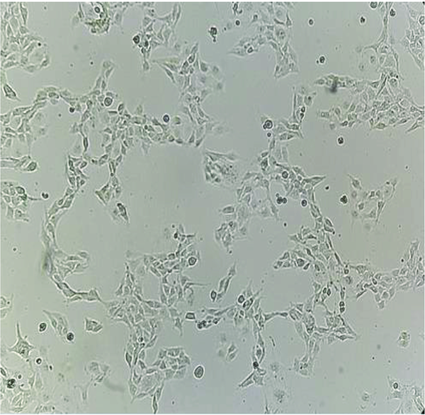 Human hepatic stellate cells after treating with a high concentration of fructose (magnification 10X)