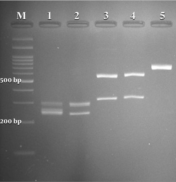 Agarose gel electrophoresis of restriction fragments length polymorphism (RFLP) of ITS gene from Candida species isolated from vulvovaginal candidiasis with Candida albicans (lanes 1, 2), C. glabrata (lanes 3, 4), C. kefyr (lanes 5), and lane M represents a 100 bp size molecular marker.