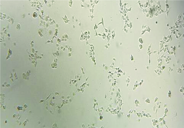 Human hepatic stellate cells before treating with fructose (magnification 10X).