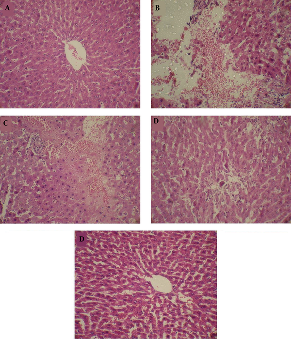 Protective effect of BPPE on histopathological changes in t-BHP-induced hepatotoxicity in rats. A, control; B, rats treated with t-BHP; C, rats treated with BPPE (100 mg/kg) + t-BHP; D, rats treated with BPPE (200 mg/kg) + t-BHP; and E, rats treated with BPPE (400 mg/kg) + t-BHP. (H &amp; E 400×).