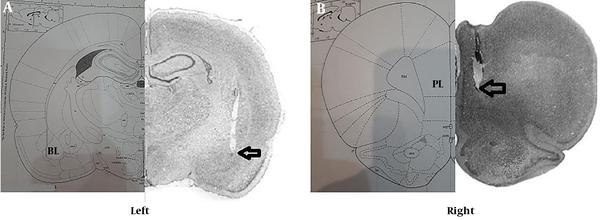 A, (left) marked position of the BLA of the right amygdala; B, (right) marked position of the PL right side.