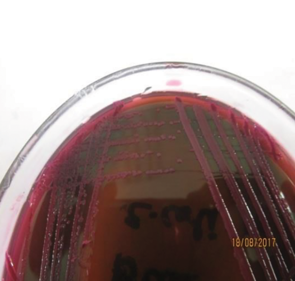 Small flat colonies with a metallic green sheen on eosin methylene blue agar (EMB)