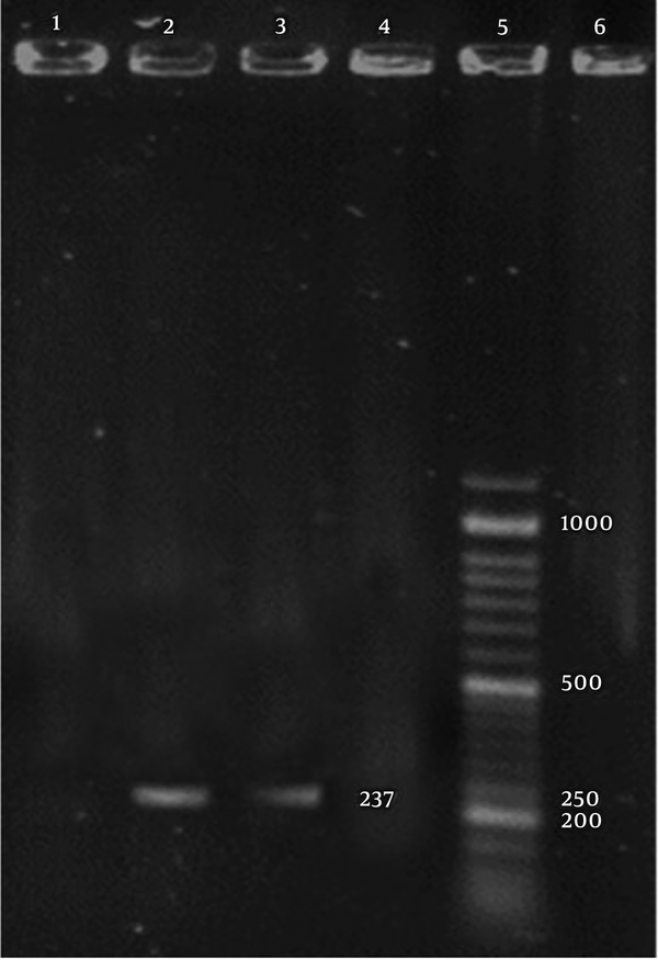 Gel electrophoresis of the PCR product for the detection of B. bronchiseptica. 2, Positive control (237 bp); 3, positive PCR product for B. bronchiseptica (237 bp); 2 - 4, negative control; and 5, 50-bp ladder.