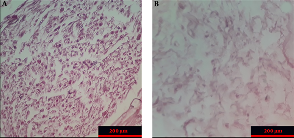 The morphology of normal nerves and decellularized scaffolds (Hematoxylin and eosin staining). Intact nerve section (A); Acellular nerve section (B).