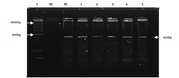 E. coli 0157:H7 amplified with the reported primer (450 bp). M: DNA marker (positive samples from well 2 to well 5). PC is the positive control, and NC is the negative control.