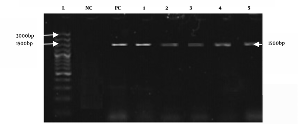 Amplified products of E. coli with universal primers (1500 bp). L: DNA ladder; NC: negative control; and PC: positive control (positive samples from 1 to 5).