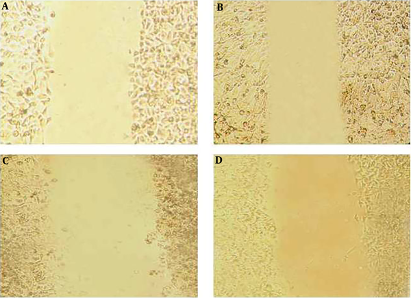 Initial images of scraped KYSE-30 cells (time 0 h) treated with different concentrations of pomegranate seed oil A: Control sample, B: Concentration 500 μg/mL, C: concentration 1000 μg/mL, D: concentration 2000 μg/mL.