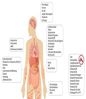 Acute Heart Failure in Multisystem Inflammatory Syndrome in