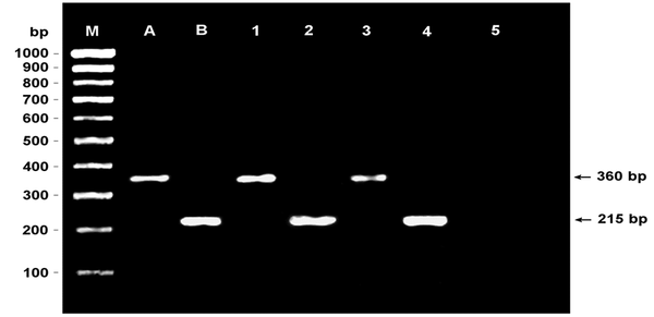 Agarose gel image of the analysis of enterococci by the multiplex PCR method (M: PCR ranger 100 bp DNA marker; A: Enterococcus faecalis positive control; B: E. faecium positive control; 1: E. faecalis positive stool specimen; 2: E. faecium positive stool specimen; 3: E. faecalis positive urine specimen; 4: E. faecium positive urine specimen; 5: negative control).