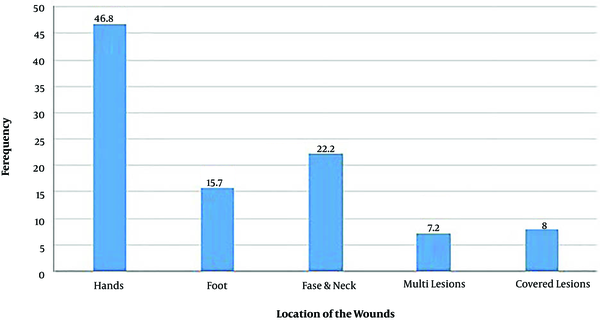 Frequency of the site of lesions in cutaneous leishmaniasis patients in Mashhad during 2015 – 2018