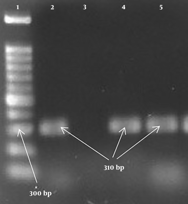 PCR products of the mecA gene: 1, Lader (100 bp); 2, positive control (310 bp); 3, negative control; 4, 5, positive specimen (310 bp).