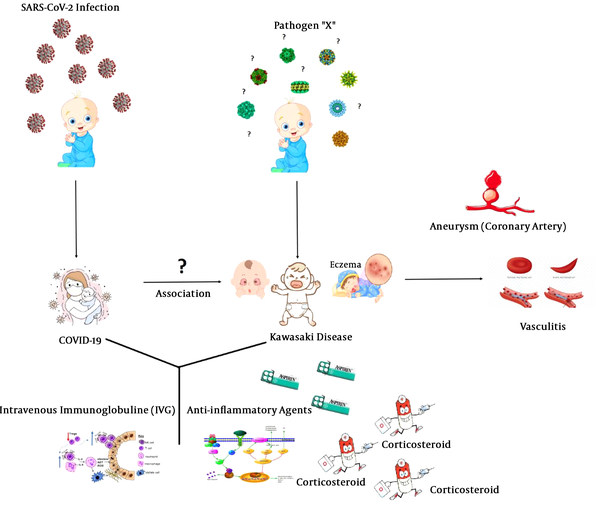 COVID-19 and Kawasaki disease in children