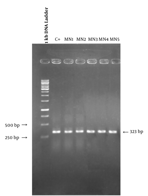 Gel electrophoresis of rpoB gene PCR products. Lanes from left to right show 1 kb DNA ladder, positive control, and MN1-MN5 PCR products.
