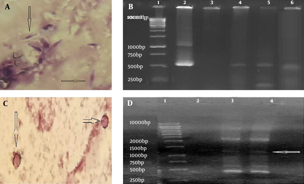 Identification of Toxoplasma and Cryptosporidium. A, Toxoplasma tachyzoites in the BAL sample by staining method (Giemsa staining, 100×); B, Toxoplasma identification by PCR method [Lane 1, marker (thermo-scientific SM0313); Lane 2, positive control; Lane 3, negative control; Lanes 4-6, positive samples with specific fragment for Toxoplasma (~529 bp)]; C, Cryptosporidium oocysts in the BAL sample by staining method (Ziehl Neelsen staining, x100); D: Cryptosporidium identification by PCR method [Lane 1, marker (thermo-scientific SM0313); Lane 2, negative control; Lane 3, positive control; Lane 4, positive sample with specific fragment for Cryptosporidium (~1325 bp)]