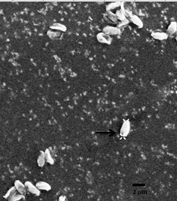 Electron micrographs the cyst. Mature spore surrounding by sporophores vesicles (SPV) (Blackhead arrows).