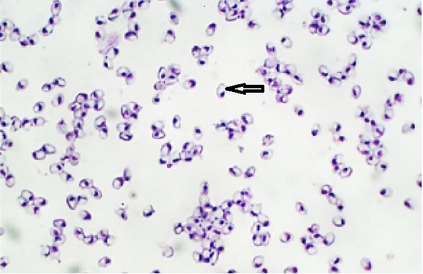 Light microscopic examination: a large number of spores in thin smear (Giemsa staining, × 1000)