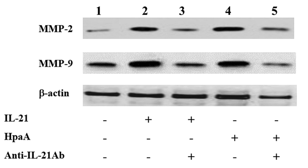 Western blotting analyses of MMP-2 and MMP-9 expressions in AGS cells with different treatments. Lane 1: AGS cells without treatment as the control; Lane 2: AGS cells treated with the IL-21 antibody (50 ng/ml) for 24 h; Lane 3: AGS cells pretreated with the IL-21 antibody (50 ng/ml) before adding the anti-IL-21 antibody (10 μg/ml) and then cultured for further 24 h; Lane 4: AGS cells co-cultured with adhesin HpaA (10 μg/mL)-stimulated CD4+ T cells for 24 h; Lane 5: AGS cells pre-co-cultured with adhesin HpaA (10 μg/mL)-stimulated CD4+ T cells before adding the anti-IL-21 antibody (10 μg/mL) and then cultured for further 24 h; The total proteins from AGS cells with different treatments were isolated for Western blotting analysis.