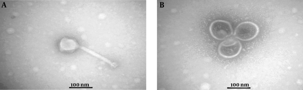 Transmission electron micrographs: A, The morphology of Siphoviridae phage, showing an icosahedral head (88 nm) and a tail (181 nm); B, The morphology of Tectiviridae phage, showing an icosahedral head (108 nm) without a head-tail. The negative control was stained by uranyl acetate 2%. TEM Zeiss -EM10C-100 KV