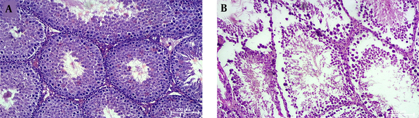 The histological examination of the testicular tissue in the control (A) and cholestasis (B) groups. Irregularity in the structure of seminiferous tubules and cellular vacuolation appeared in the testes of cholestasis rats. H &amp; E staining; × 100.