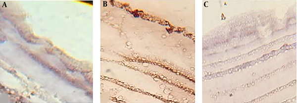 Caspase-3 expression in the hydatid cyst wall after 24 hours of exposure to A) phosphate buffer (control); B) 100% concentration (0.49 gr/mL) of crude extract; and C) 100% concentration (1.35 gr/mL) of flavonoid extract