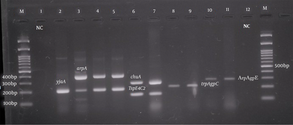 Phylogenetic analysis of pathogenic Escherichia coli isolates. Left to right: 100 bp marker, well number one as a negative control, well numbers 2, 3, 4, and 5 with yjaA (211 bp) and arpA (400 bp), well numbers 6 and 7 with chuA (288 bp) and TspE4.C2 (152 bp), well numbers 8 and 9 with trpAgp C (219 bp), and well numbers 10 and 11 with ArpAgpE (301 bp) genes.