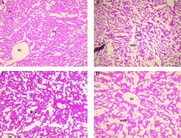 Hematoxylin and eosin staining of hepatic tissues from A, control showing distinct centriole (DC), portal vein (PV) and fenestrated sinusoids (FS); B, Cr showing marked cell necrosis (CN), sinusoidal and portal vein dilation with multifocal distortion (MD); C, Cr + A*; and D, Cr + A showing distinct centriole (DC) with mild sinusoidal and portal vein dilation (MSD) (× 400).