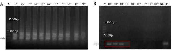 Sensitivity of RT-LAMP assay for the detection of the speB gene using a 10-fold serial dilution ranging 102-10-6 ng/µl in this study. Agarose gel electrophoresis of LAMP and conventional PCR products were compared in (a) and (b). M: a 100-bp ladder, PC: positive control, NC: negative control. The red box highlights the presence of PCR products at only 102, 101, and 100 ng/µl concentrations and the absence of PCR products at 10-1 ng/µl in the conventional PCR assay in (b).