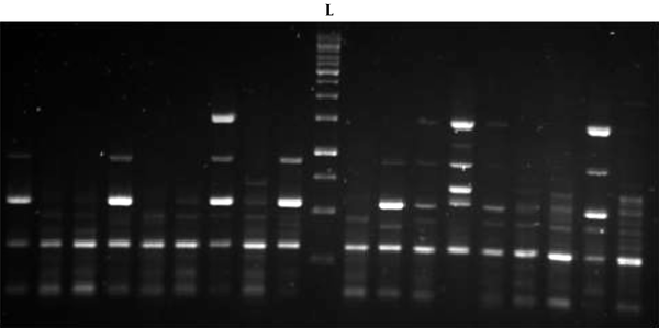 Repetitive element sequence-based PCR patterns of MBL-producing Klebsiella pneumoniae strains. L: Ladder 250 bp