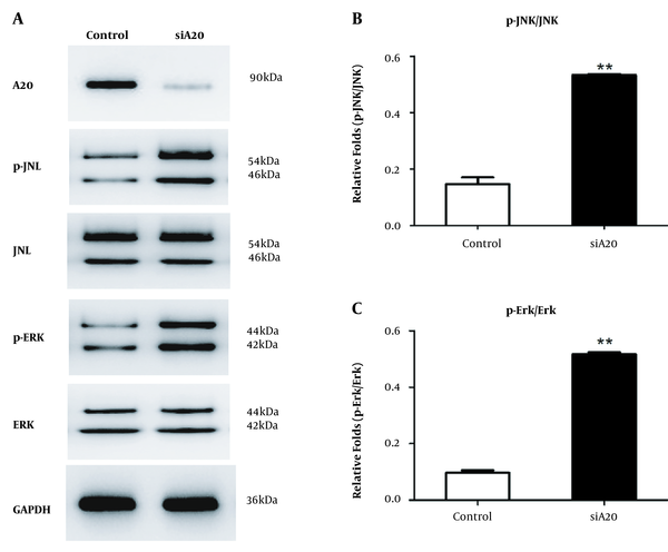 Function of silencing A20 in MAPK/ERK/JNK pathway. A, Protein levels of phosphorylated MAPK/ERK/JNK in LX-2 cells transfected with A20-siRNA exposed to 0.1 μg/mL LPS for 30 min. GAPDH served as the loading control. B, Graph shows relative fold changes of p-JNK/JNK. C, Graph shows relative fold changes of p-ERK/ERK. P-JNK, JNK, p-ERK, and ERK represented as the sum of two bands.