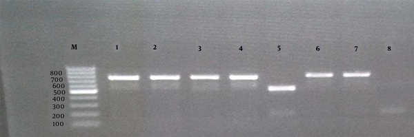 Agarose gel electrophoresis (1%) of the PCR products amplified by the AMOS-PCR of bacterial DNA samples. The “M” shows the DNA marker (100 bp DNA ladder). Lanes 1, 2, 3, 4, and 7 show Brucella melitensis  field strains; Lane 5, B. abortus 544 as the reference; Lane 6, B. melitensis 16 M as the reference; Lane 8, negative control.