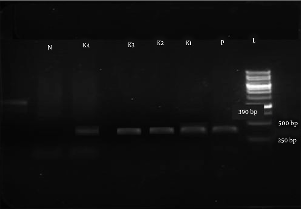 Gel electrophoresis of the blaVIM gene with 390 bp size in four Klebsiella pneumoniae isolates (K1, K2, K3, and K4). L: DNA marker 250 bp, P: Positive control, N: Negative control