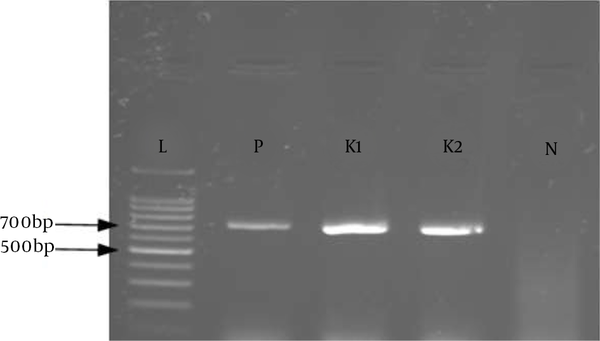 Gel electrophoresis of the blaNDM gene with 761 bp size in two Klebsiella pneumoniae isolates (K1 and K2). L: DNA marker 100 bp, P: Positive control, N: Negative control