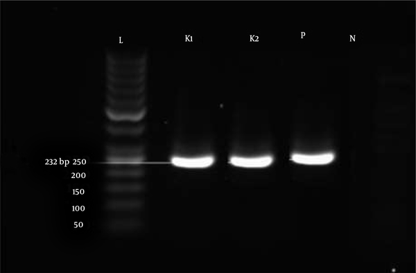 Gel electrophoresis of the blaIMP gene with 232 bp size in two Klebsiella pneumonia isolates (K1 and K2). L: Ladder 50 bp, P: Positive control, N: Negative control
