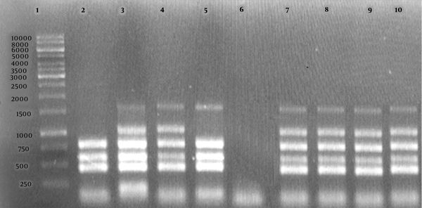 Agarose gel electrophoresis (1%) of the PCR products amplified by the Bruce-ladder PCR of bacterial DNA samples. Lane 1 shows the DNA marker (1000 bp DNA ladder). Lane 2 shows Brucella abortus  RB51; Lane 3, B. melitensis Rev1; Lane 4, B. melitensis 16 M; Lane 5, B. abortus 544; Lane 6, negative control, Lanes 7 - 10, B. melitensis field strains.