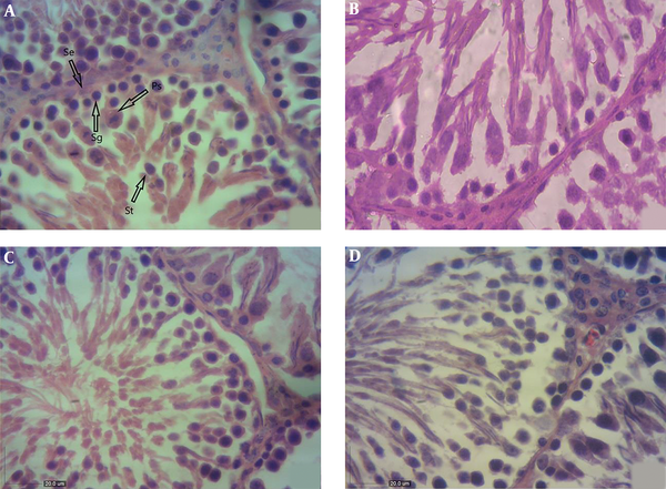 A, Light photomicrographs of the testis in the control group (H&E, X400); the shape of seminiferous tubules and the height of the epithelial layer are normal. Arrows: Ps: primary spermatocyte; Sg: spermatogonia; St: spermatid; Se: Sertoli cells. B, Light photomicrographs of the testis in the tacrolimus-received group (H&E, X400); the seminiferous tubules have an irregular shape and the epithelium is desultory. The number of primary spermatocytes and Leydig cells reduced. C, Light photomicrographs of the testis in the tacrolimus and captopril receiving group (H&E, X400); the shape of seminiferous tubules and the height of the epithelial layer are normal. D, Light photomicrographs of the testis in the tacrolimus and losartan receiving group (H&E, X400); the shape of seminiferous tubules is normal and their epithelial layer is thick.