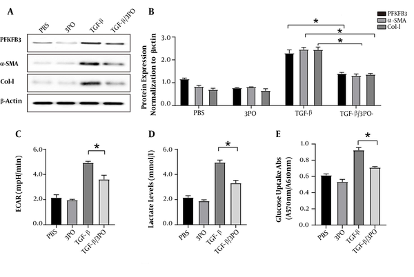 Inhibition of PFKFB3 by 3PO blocks aerobic glycolysis and activation of LX2 cells. After LX2 cells were activated by TGF-β1, they were treated with 3PO. A and B, WB detection of changes in protein expression levels of PFKFB3, α-SMA, and Col-I in the experimental groups with or without TGF-β1 stimulation and with or without 3PO treatment; C, real-time extracellular acidification rate (ECAR) was recorded and showed the basal levels of ECAR (n = 6). * P < 0.05 compared with time zero by unpaired Student’s t test; D, measurement of lactate in cell culture medium; * P < 0.05; E, measurement of cell glucose uptake; * P < 0.05.