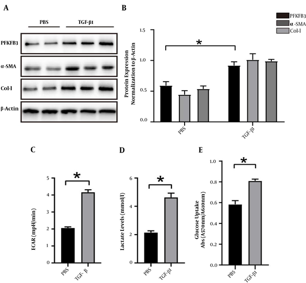 The expression of PFKFB3 and changes of aerobic glycolysis in LX2 cells induced and activated by TGF-β1. A, expression of PFKFB3, type I collagen, and α-SMA protein in LX2 cells after TGF-β1-induced activation, with β-actin as the internal control; B, analysis of the relative expression levels of PFKFB3, type I collagen, and α-SMA protein (* P < 0.05); C, real-time extracellular acidification rate (ECAR) was recorded and show the basal levels of ECAR (n = 5). * P < 0.05 compared with time zero by unpaired Student’s t-test; D, measurement of lactate in cell culture medium; * P < 0.05; E, measurement of cell glucose uptake; * P < 0.05.
