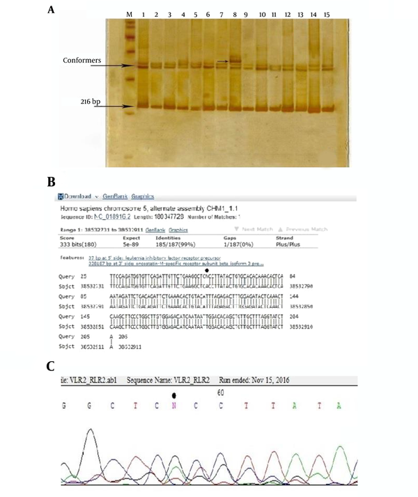 The SSCP gel electrophoresis of 216 bp PCR products of the 5’ upstream region of LIFR gene using 10% gel acrylamide in TBE buffer (1X). M: DNA size marker, numbers 1 - 10: samples of the patients and 10 - 15 samples of the control group. The new conformer is shown in sample 8; B, the result of the homology analysis of the sequence of this PCR product. Location of the polymorphism is determined by the star; C, chromatogram of this area. Polymorphism is observed as a heterozygote. The position of this polymorphism was named rs38532765 a/g.