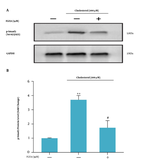 A, western blot analysis of Smad3C expression in LX-2 cells. LX-2 cells were treated with 1 μM FGF21 for 4 h before being incubated with cholesterol for 4 h; the cell lysates were immunoblotted; B, the relative Smad3C level. The relative Smad3C level was expressed as the ratio of Smad3C/GAPDH. The bands were analyzed with ImageJ software. The data were performed using a one-way analysis of variance (ANOVA), followed by Tukey's test. Data represent the mean ± SEM of three replicates; ** P < 0.01 vs. vehicle-treated control, # P < 0. 05 vs. cholesterol alone.