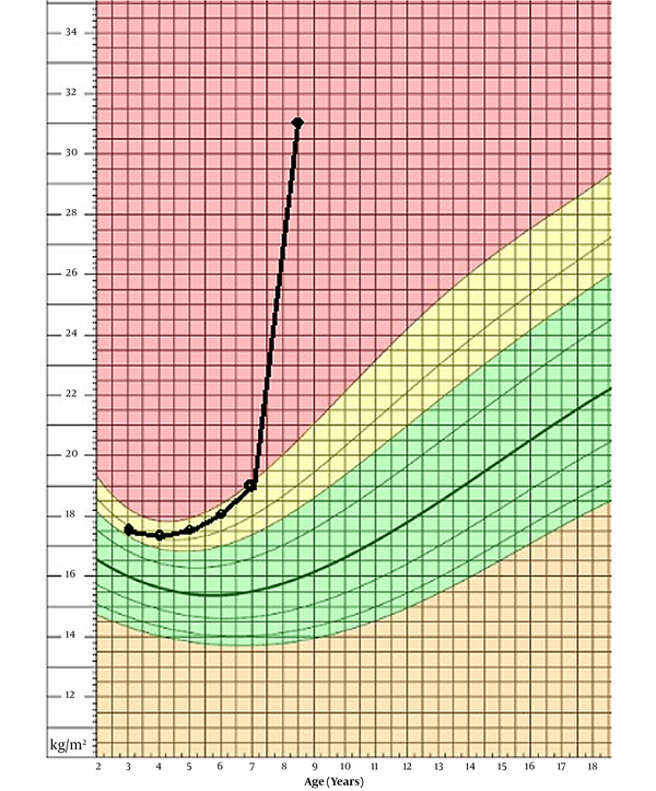 The patient’s body mass index on growth chart.