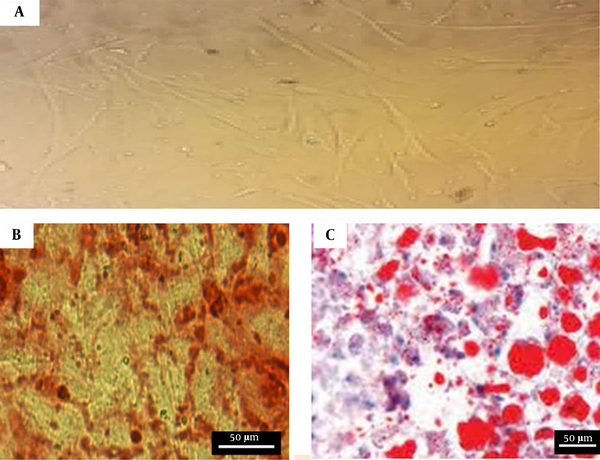 Characteristics of BM‐MSCs: A, BM‐MSCs at passage 3. The cells have a fibroblast-like morphology; B, Osteogenic differentiation potential of BM‐MSCs. Calcium crystals are presented in alizarin red staining; C, Adipogenic differentiation potential of BM‐MSCs. Lipid droplets are shown in oil-red-O staining.