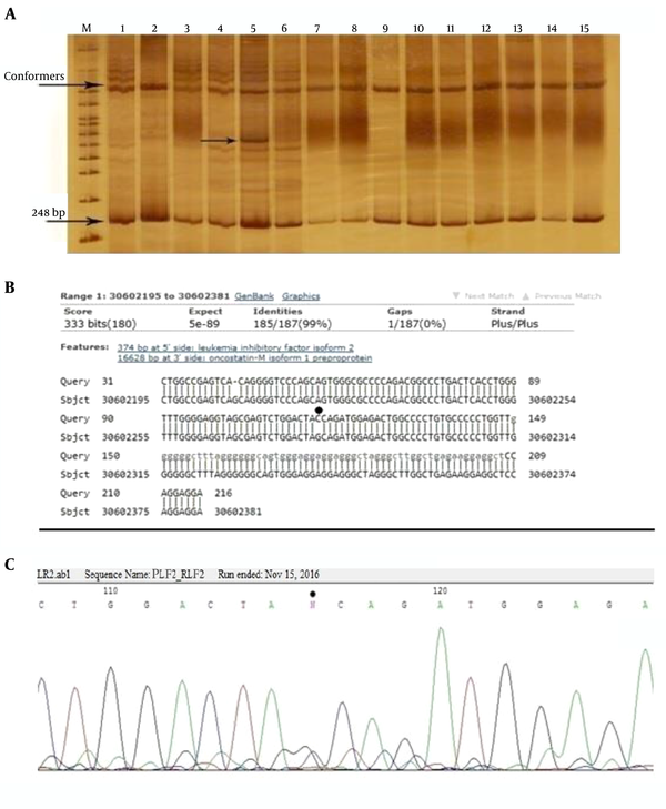 A, The SSCP gel electrophoresis of 248 bp PCR products of the 5’ upstream region of LIF gene using 10% gel acrylamide in TBE buffer (1X). M: DNA size marker, numbers 1 - 10: samples of the patients and 10 - 15 samples of the control group. The new conformer is shown in sample 5; B, the result of the homology analysis of the sequence of this PCR product. Location of the polymorphism is determined by the star; C, chromatogram of this area. Polymorphism is observed as a heterozygote. The position of this polymorphism was named rs30602282g/c. Such a polymorphism on the SNPedia site was not previously reported.