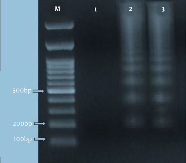 The DNA fragmentation detection of Leishmania major on agarose gel electrophoresis. Lanes: Lane M, size marker, lane 1, not treated; lane 2, Positive apoptotic cell (positive control); lane 3, 72 h after treatment with HESA-A.