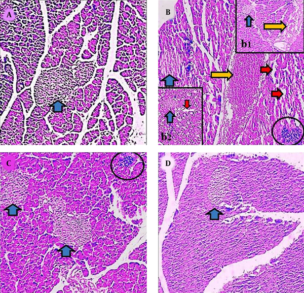 Microscopic figures of pancreas tissue (4 µm, H &amp; E, 100×). Micrograph of the pancreas section in the control groups (A), normal pancreas tissue. Micrograph of the pancreas section of γ-ray group (B, b1, b2), vacuolization in tissues (red arrow), reduction of islet size (blue arrow), and hyperemia (yellow arrow). Micrograph of the pancreas section in AJ group (2,000 mg/kg) (C), normal pancreas structure. Micrograph of pancreas section in AJ + γ-ray group (2,000 mg/kg) (D), normal pancreas tissues. AJ, Allium jesdianum.