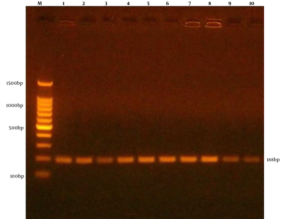 The results of the amplification of icaA gene of Staphylococcus aureus samples were fractionated on 1.5% agarose gel electrophoresis stained with Eth.Br. M: 100 bp ladder marker. Lanes 1 - 10 represent 188 bp PCR products.