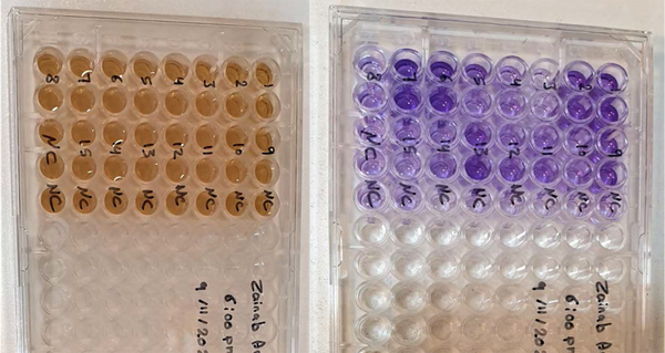 Biofilm formation by Staphylococcus aureus isolates
