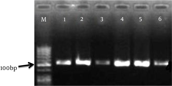 Columns 1, 2, 3 and 4 of the Bap gene PCR product, column 5 of the 16s rRNA gene PCR product, column 6 of the standard strain PCR product and column M (100 bp marker) are shown. The amplified fragment is 127 bp for the Bap gene and 110 bp for the 16s rRNA gene.