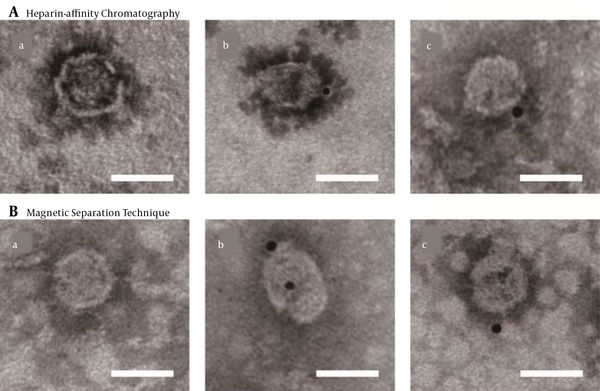 Immuno-electron microscopy of purified JFH-1 virus from: A, Heparin-affinity chromatography; and B, Magnetic Separation technique. Purified viruses were absorbed on microscopy grids and incubated with anti-hepatitis C virus (HCV) envelope protein 2 (E2) antibody AP33. Bound antibodies were detected with Anti-Mouse IgG (whole molecule)-Gold (10 nm in diameter). The lowercase letter (a) indicated the grids with purified virus incubated with non-related primary antibody (an anti-brucellosis bp26 antibody), while (b) and (c) with anti-HCV E2 antibody (scale bar: 50 nm).
