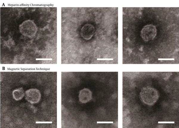 Electron microscopy of purified JFH-1 viruses from: A, Heparin-Affinity chromatography; and B, Magnetic Separation technique. After purification, the eluted fraction was absorbed on microscopy grids and negative stained. The grids were observed by transmission electron microscopy (scale bar: 50 nm).